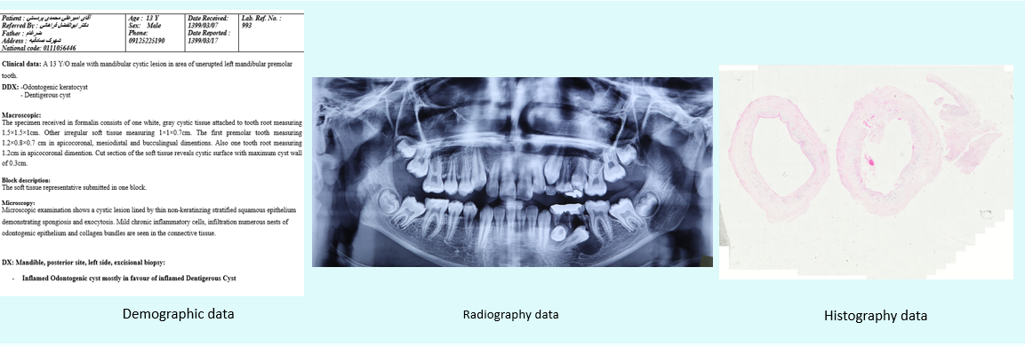 Multimodal-AI-Odontogenic-Cyst-Diagnosis